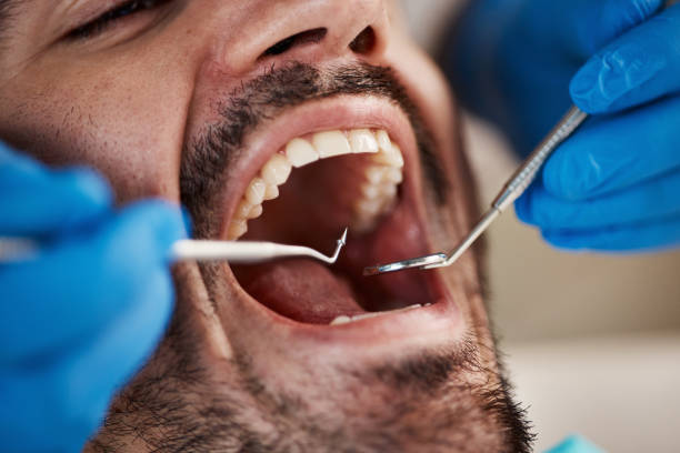 Best Knocked-Out Tooth Emergency  in Havre De Grace, MD